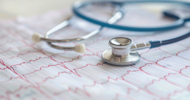 apple health scale - photo of a stethoscope on top of an ekg printout